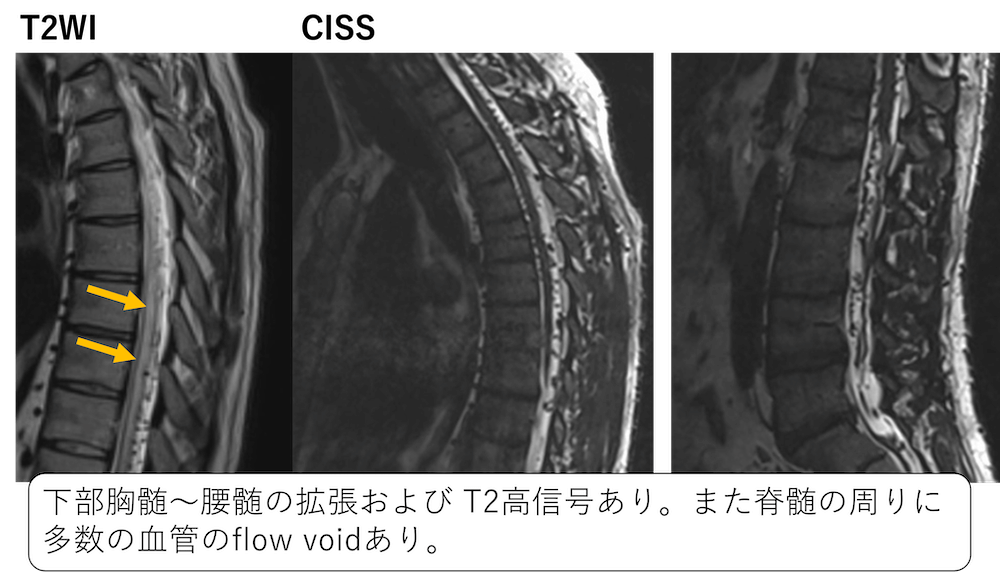 年末のプロモーション特価！ プライム 脳神経外科 脳・脊髄動静脈奇形